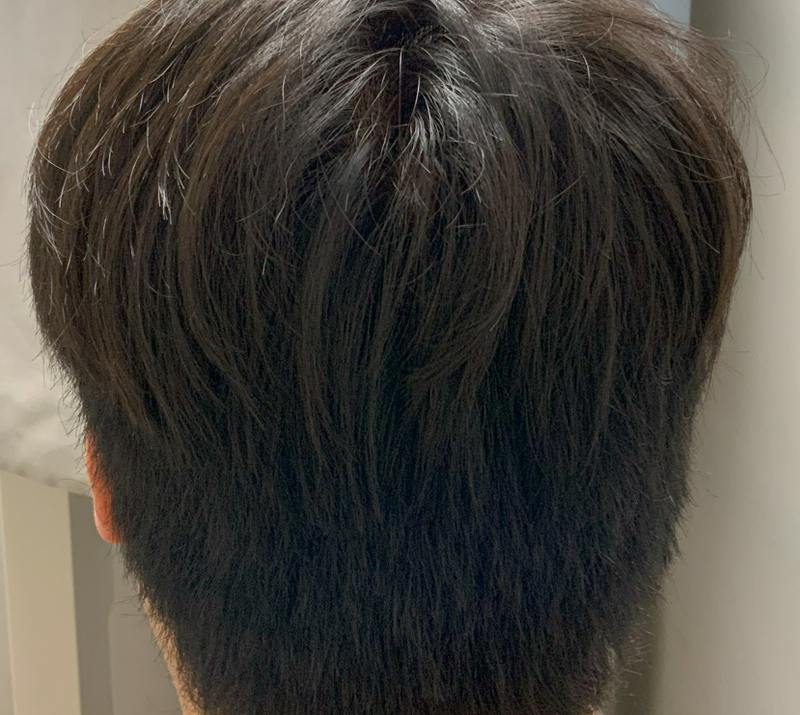 심지환94 3000모 비삭발 후두부 후.png