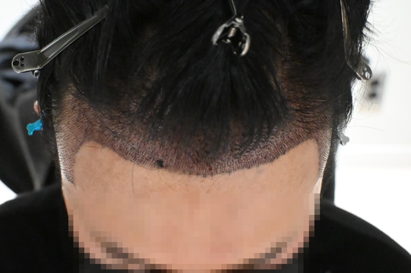 샴푸 후 디자인(정면2).jpg