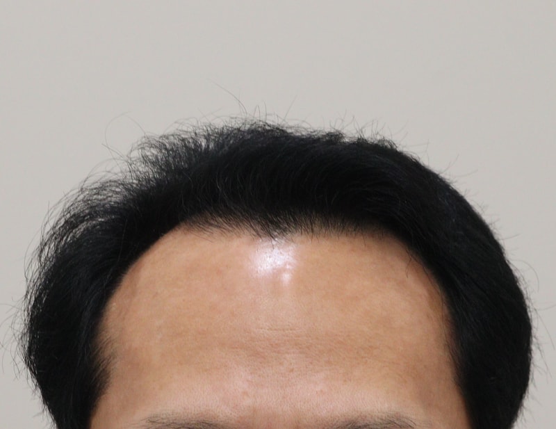 6개월인데도 풍성하네요~~~~