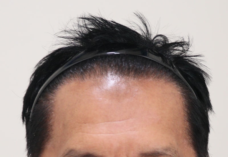 7개월되니 많이 자랏네요