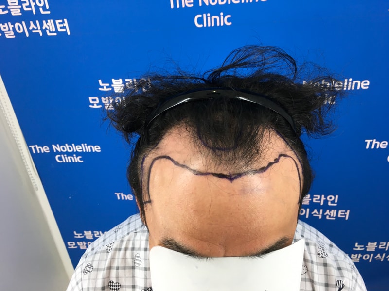 포토후기 이미지