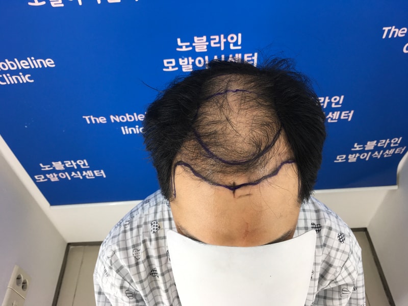 포토후기 이미지