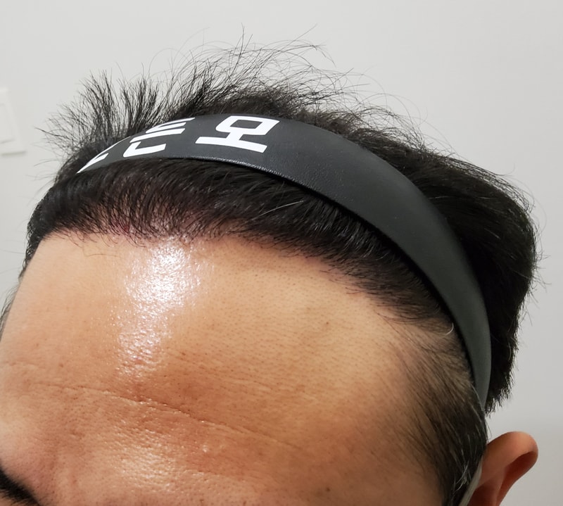 5. 수술후_1년_2.jpg