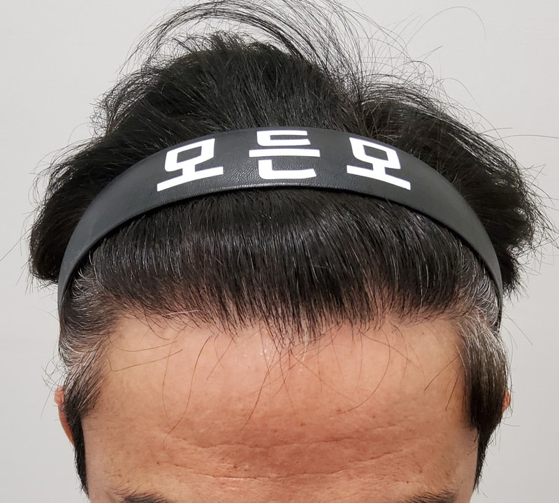 4. 수술후_1년_1.jpg
