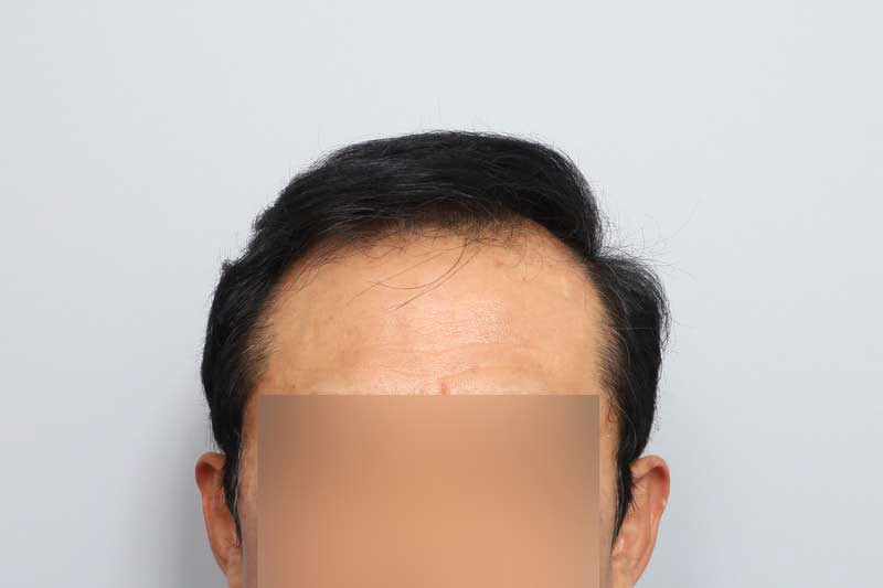 포토후기 이미지
