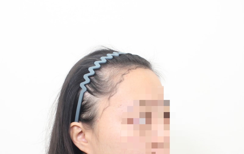 포토후기 이미지