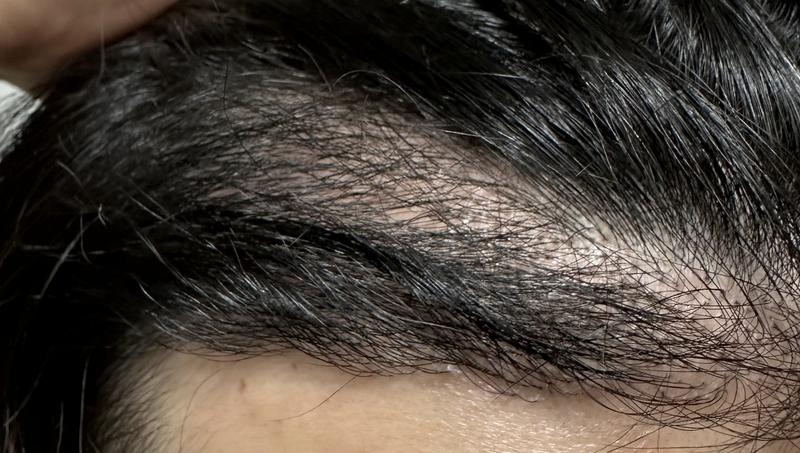 It's been five months.