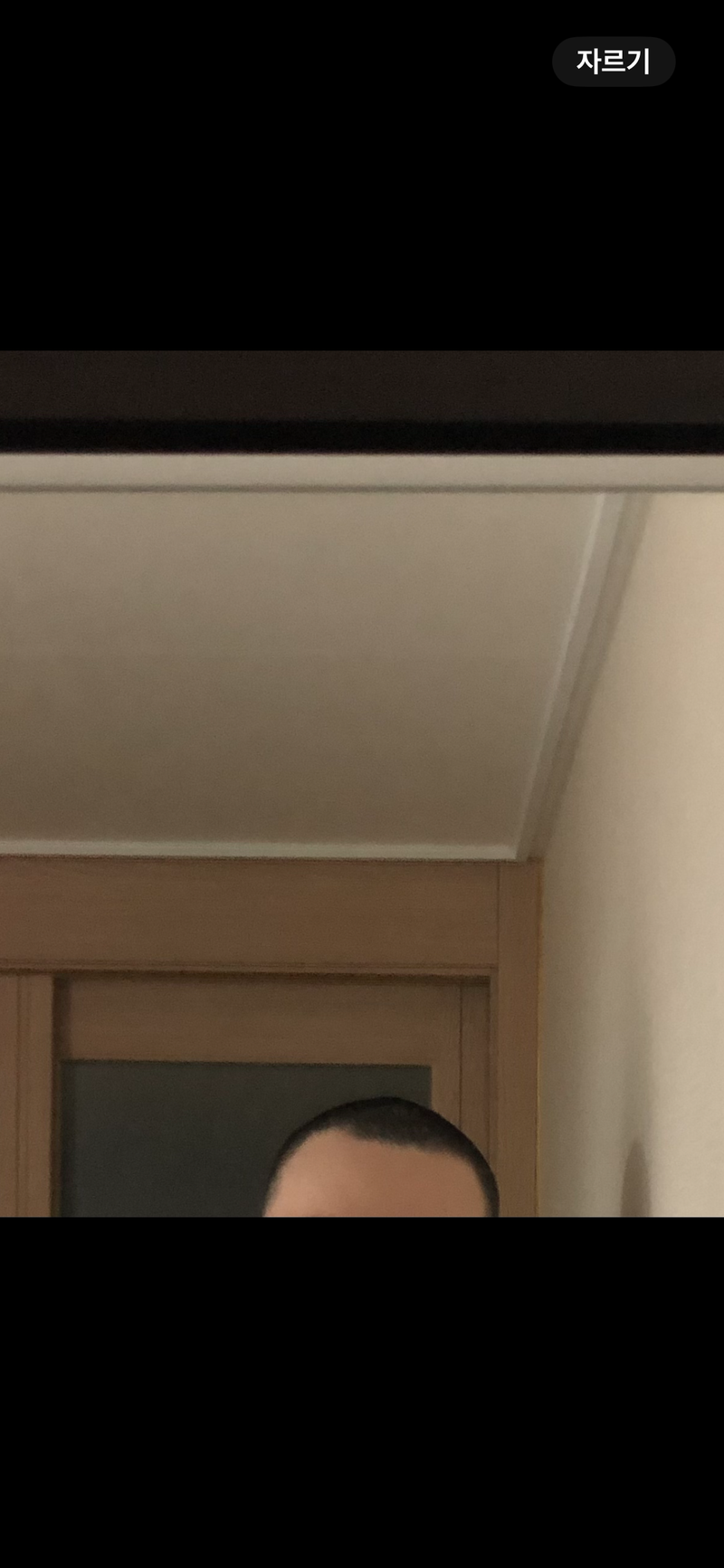 절개 3천모 종결 후기입니다.