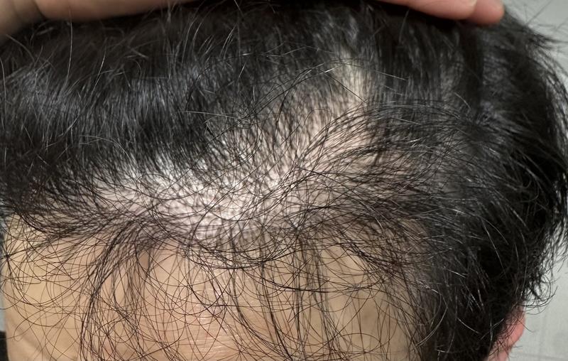It's been 7 months. (Additional photo)