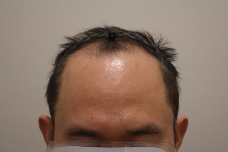 포토후기 이미지