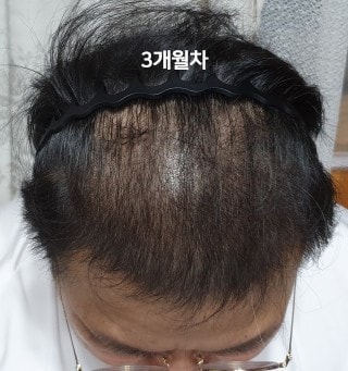 3개월.jpg