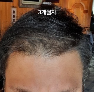 3개월차.jpg