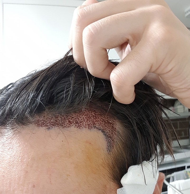DCMI2018071720225.jpg