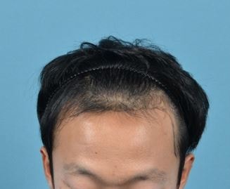 캡처.JPG