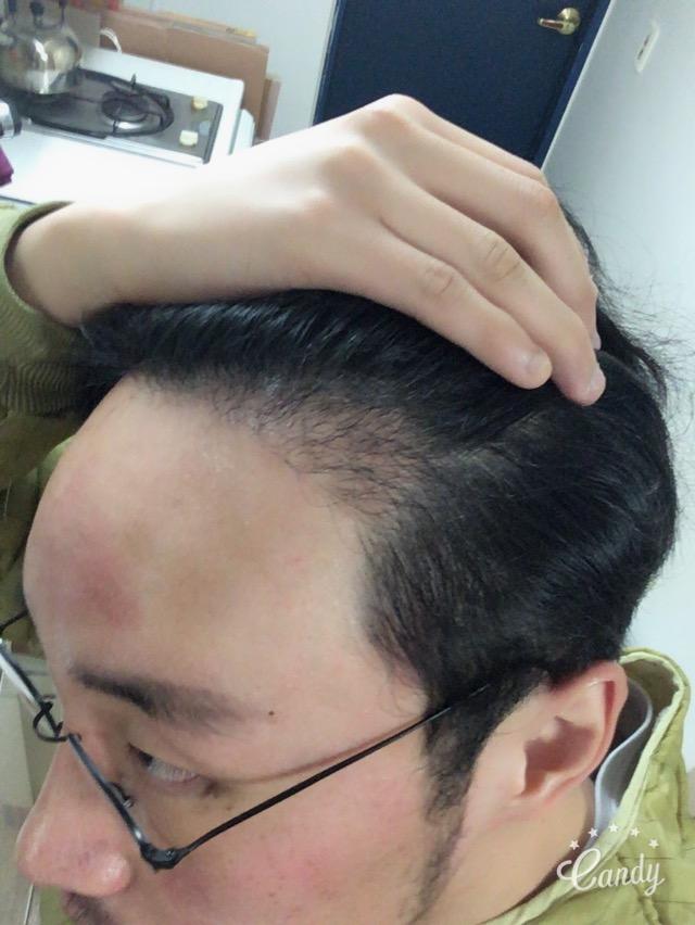 6ヶ月目···