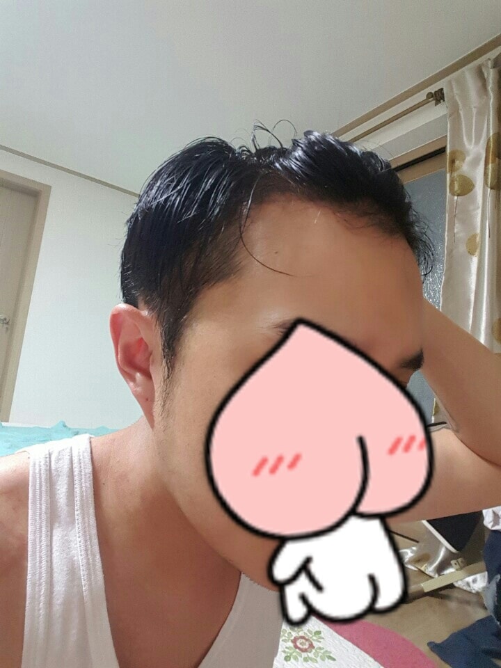 大邱经过119天Pohair