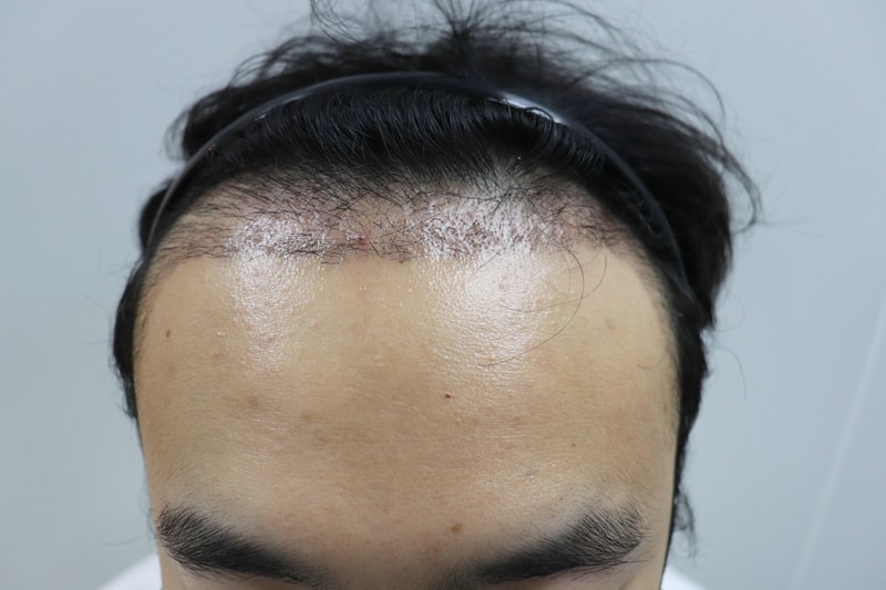 1개월차 3.jpg