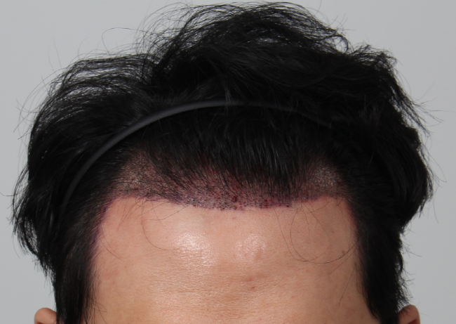 [크기변환]후1.png