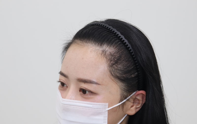 수술4개월22.jpg