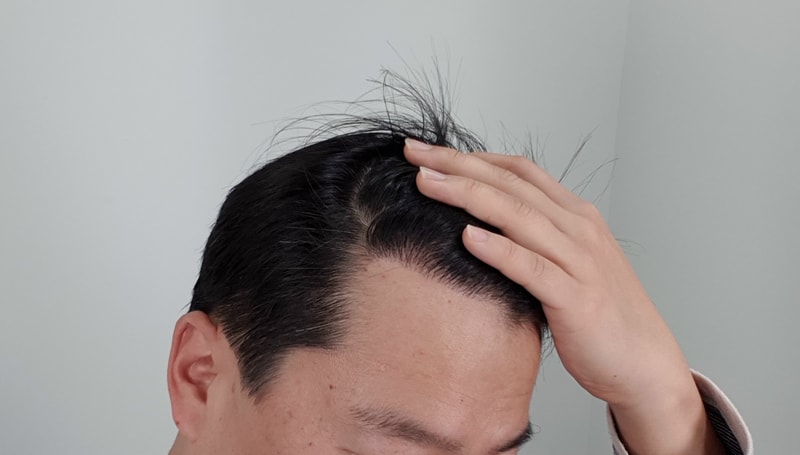 7개월 오른쪽.jpg