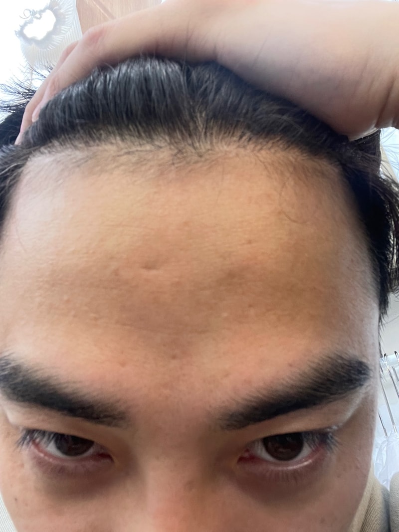 The final review of the hospital's forehair that I chose with my brother