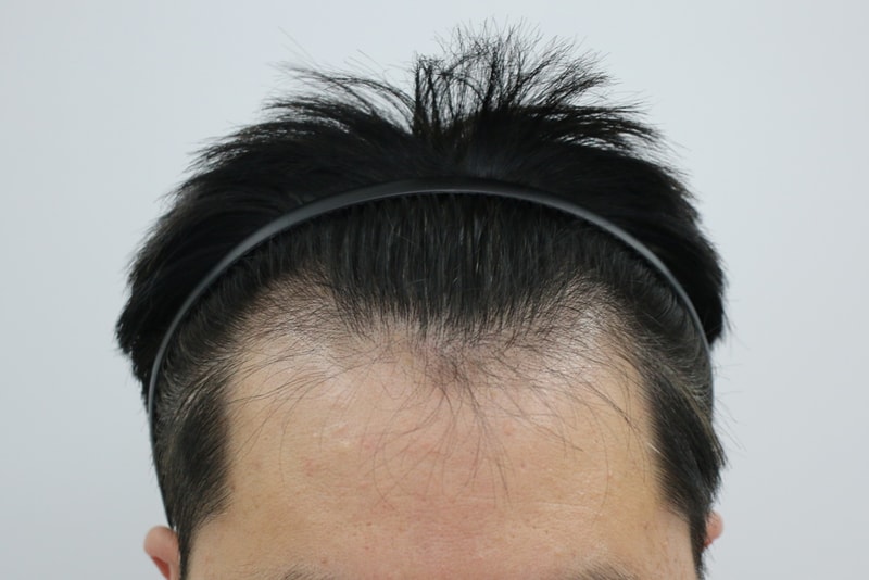 수술전11.jpg