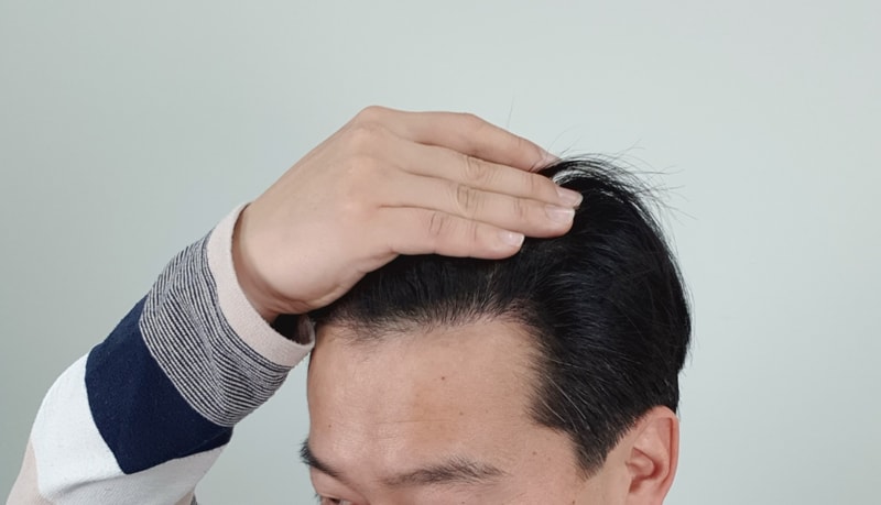 7개월 왼쪽.jpg