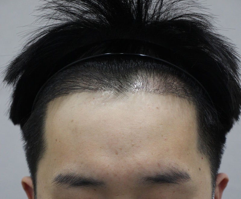 4개월.jpg