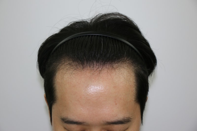 수술전1.JPG