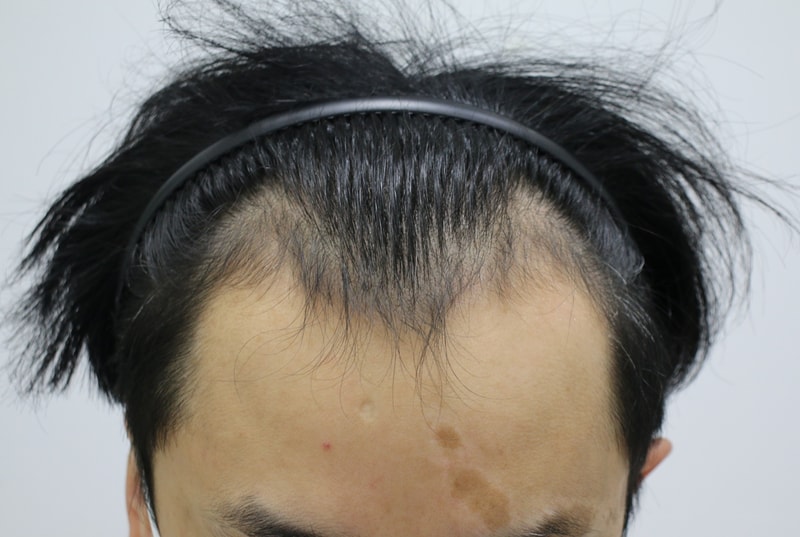 수술전.jpg
