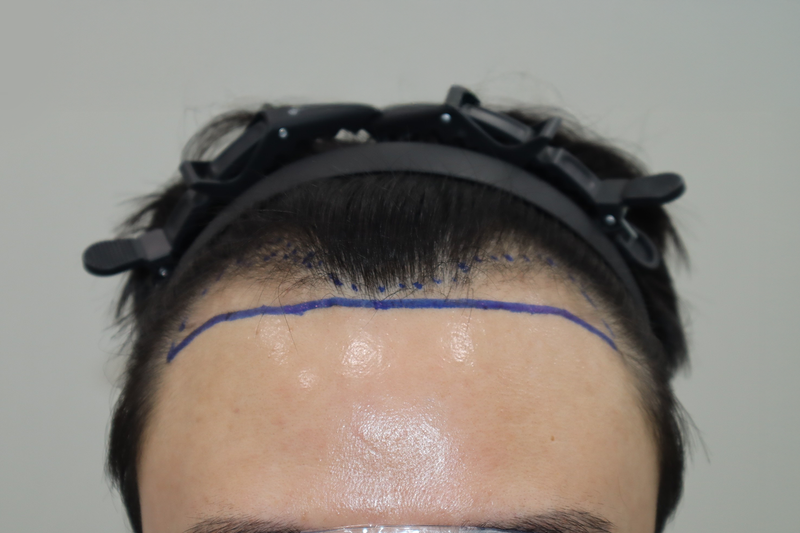 포토후기 이미지