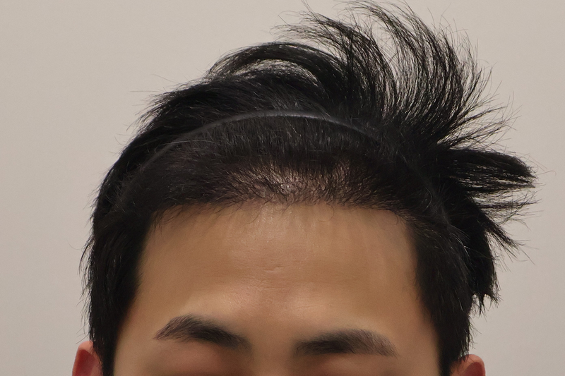 1.png