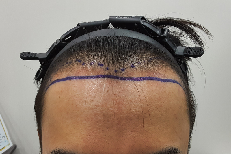 포토후기 이미지