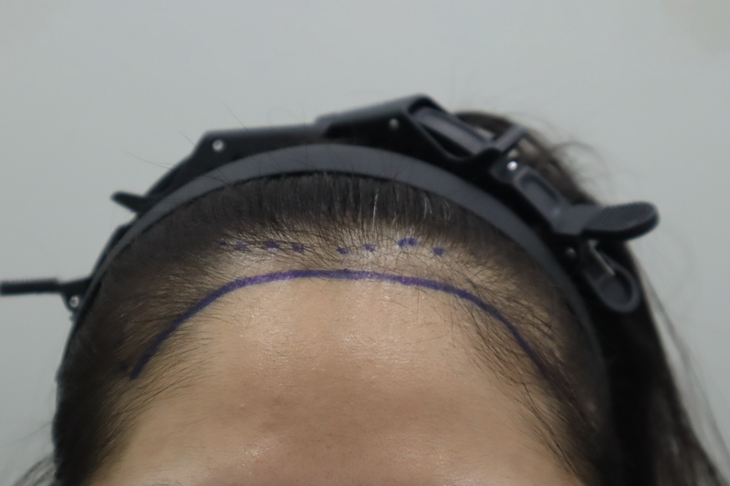 포토후기 이미지