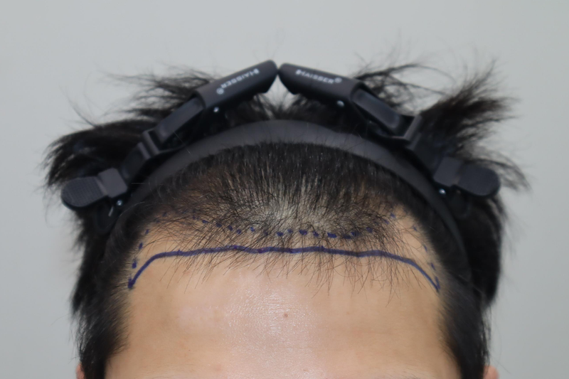 포토후기 이미지