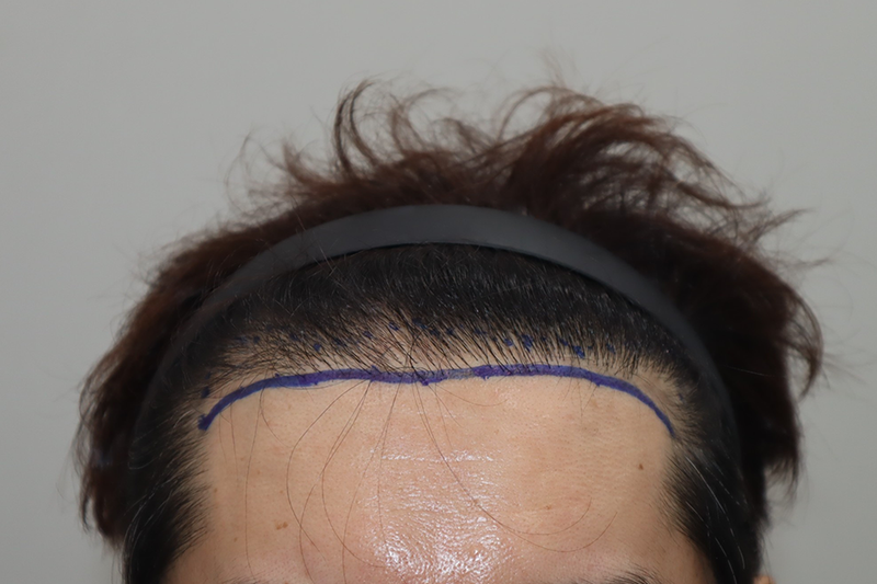 전주 헤어로 2천모 심은 2주 후기