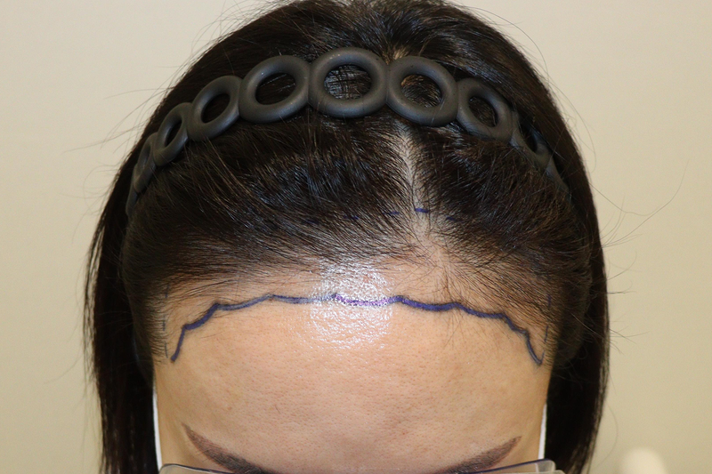 포토후기 이미지