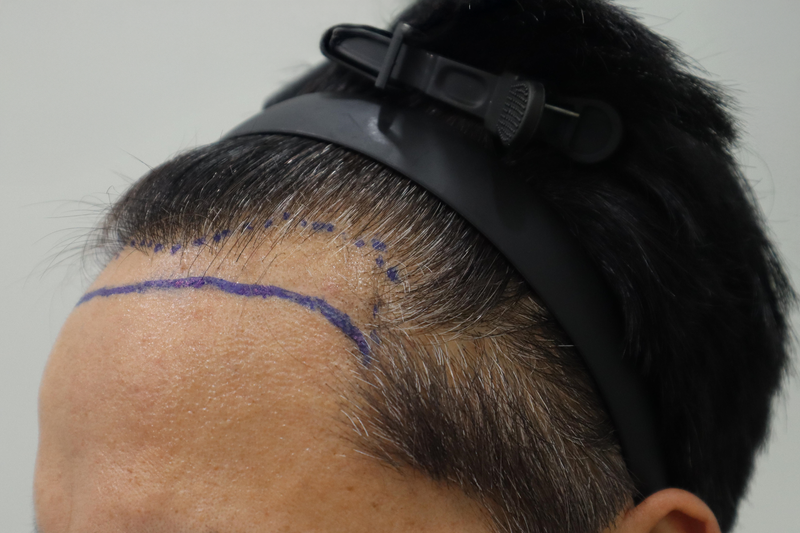 김성수 수술디자인 7.png