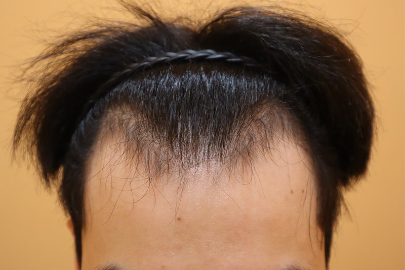 포토후기 이미지