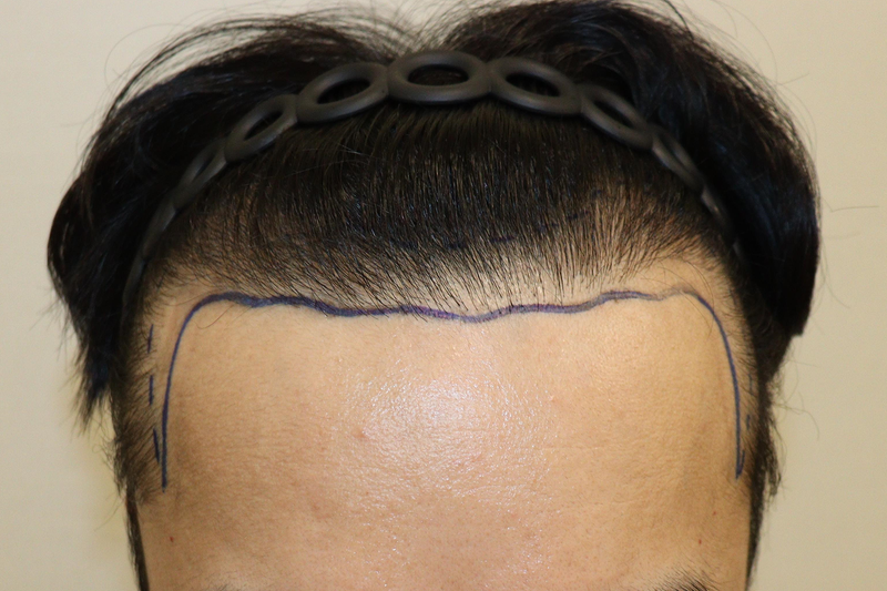 포토후기 이미지