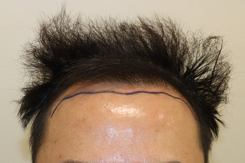 포토후기 이미지