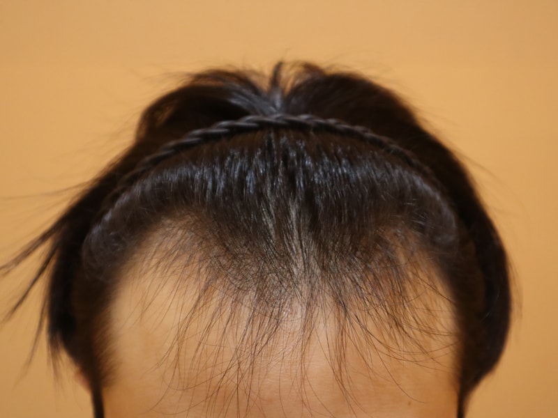 포토후기 이미지