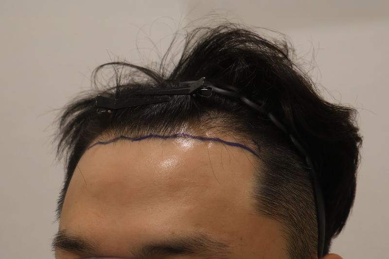 3.png