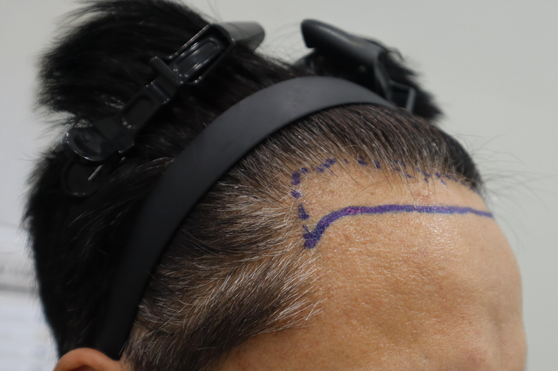 김성수 수술디자인 9.png