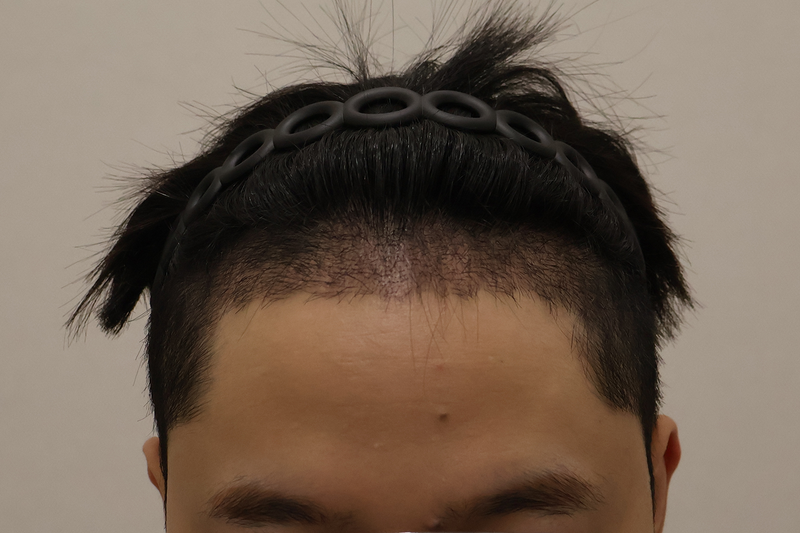 1.png