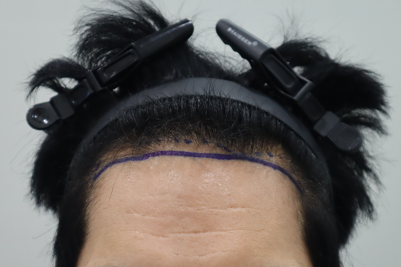 전주헤어로 1600모 2주 경과, 진작에 받을껄 그랬습니다