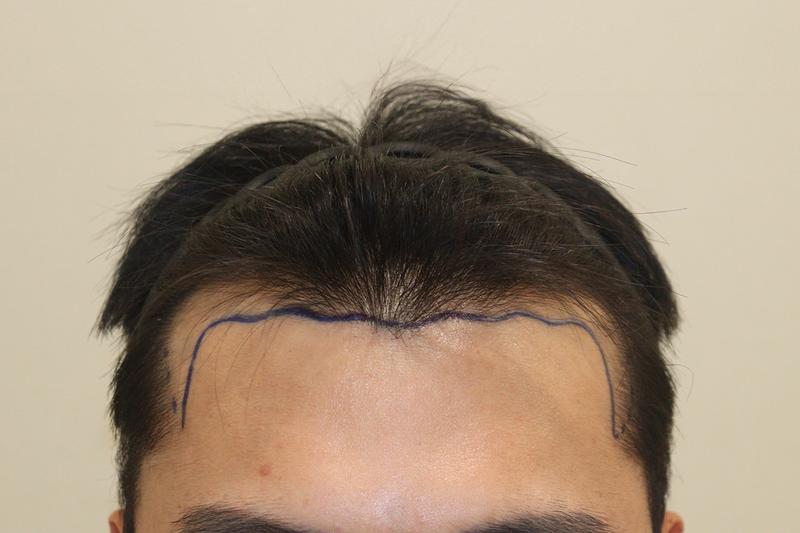 포토후기 이미지