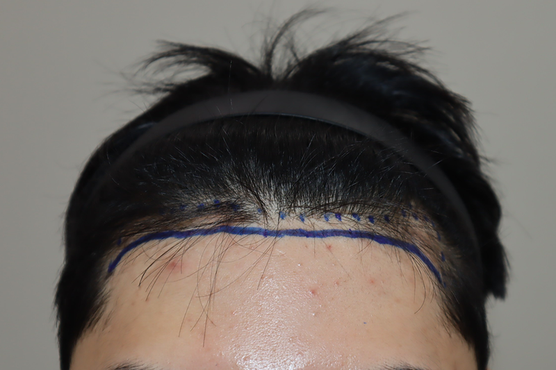 포토후기 이미지