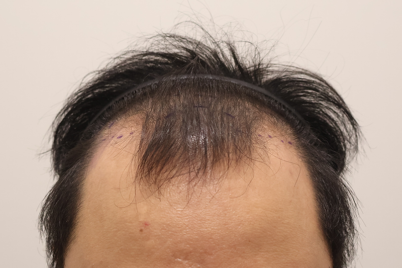 포토후기 이미지