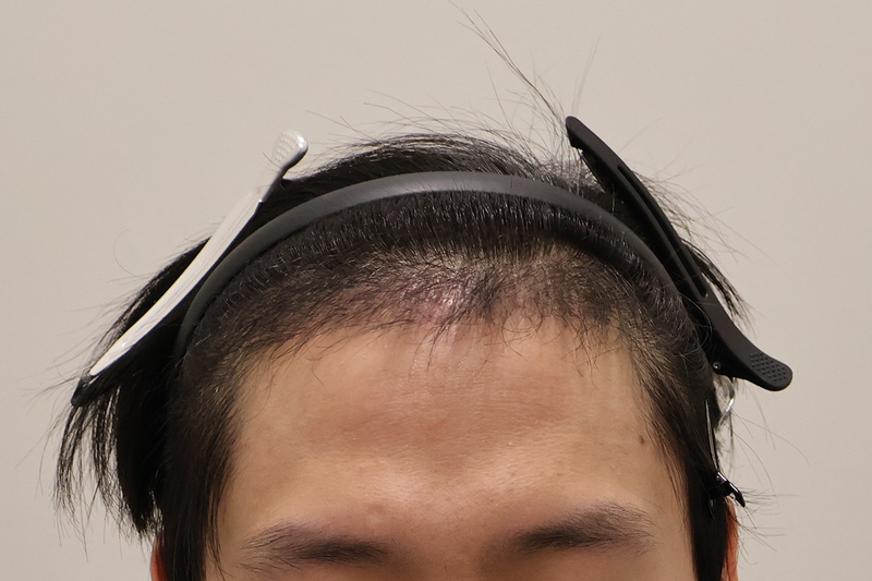 1.png